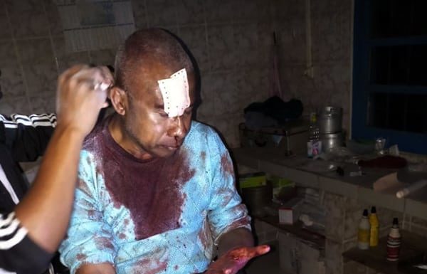 Diserang Bandit, Dua Misionaris Luka Parah Pater Alex Dhae