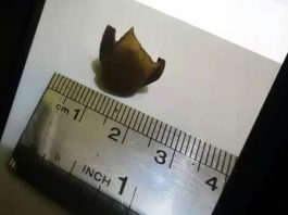Potongan Jari Manusia yang ditemukan di dalam sayur lodeh di salah satu warung makan di Atambua, Belu, NTT.
