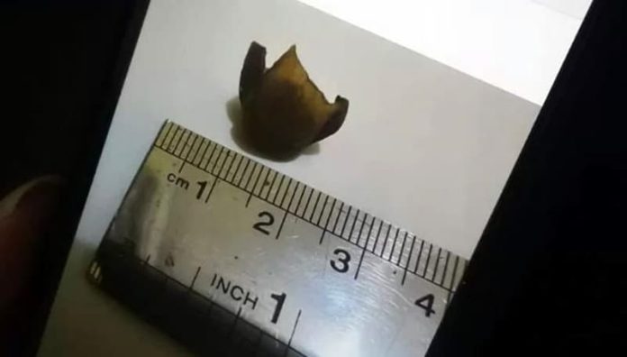 Potongan Jari Manusia yang ditemukan di dalam sayur lodeh di salah satu warung makan di Atambua, Belu, NTT.