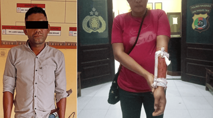Minta Rp 5 Juta Tak Dituruti, Istri Dianiaya Hingga Tangan Patah pelaku dan korban