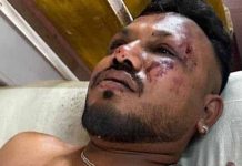 Ramesh, Satu-Satunya Penumpang Yang Selamat dari Jatuhnya Pesawat Air India Ramesh Vishwaskumar Bucharvada