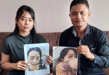 Oknum BIN Aniaya Istri, Kasusnya Sudah P21, Tapi Pelaku Belum Ditahan Amel dan Frangky