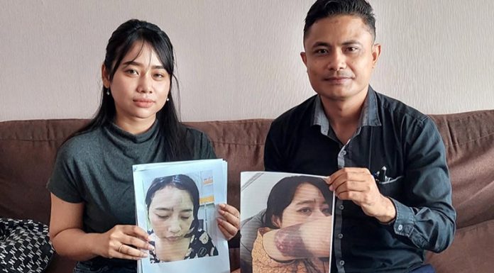 Oknum BIN Aniaya Istri, Kasusnya Sudah P21, Tapi Pelaku Belum Ditahan Amel dan Frangky