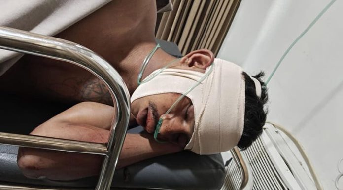 Curi Motor: Dua Pemuda Asal Sumba Bonyok Dihajar Massa pelaku curanmor asal sumba