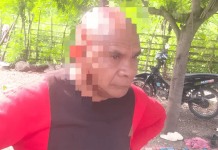 Guru di TTU Dihajar Brutal: Dua Kali Diserang, Kepala Luka Parah Kena Gelas Kaca Edmundus Lopo