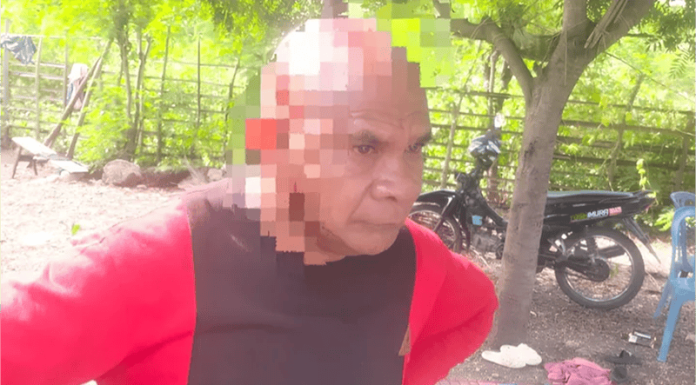 Guru di TTU Dihajar Brutal: Dua Kali Diserang, Kepala Luka Parah Kena Gelas Kaca Edmundus Lopo